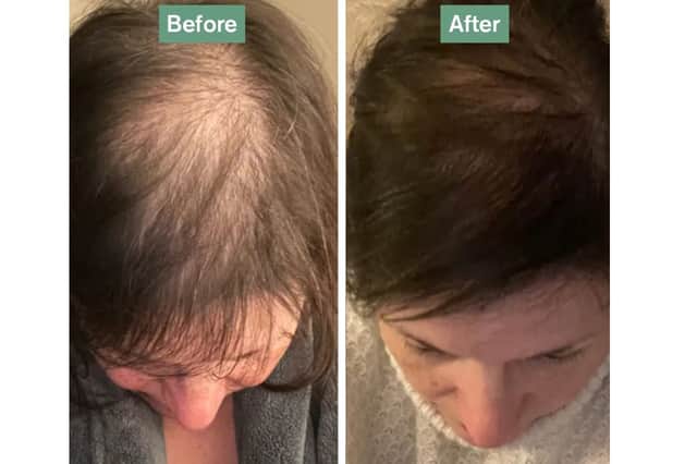 Dr Vegan Hair Saviour - before and after results