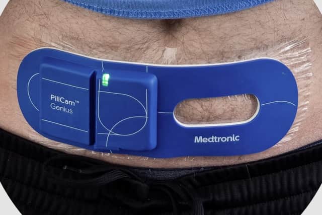 The new stick-on version that enables patients to get on with their normal life without inconvenience.