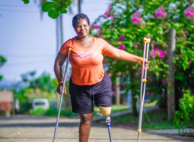 Catherine from Ghana. She lost her leg in a road traffic accident, and now has been fitted with a leg from STAND.