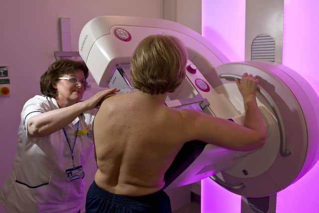 A mammogram is an X-ray of the breast