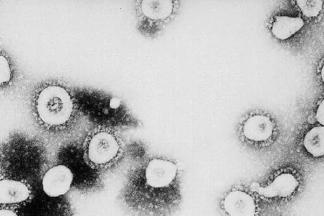 The patient was infected by coronavirus while in Italy. Photo: Getty Images