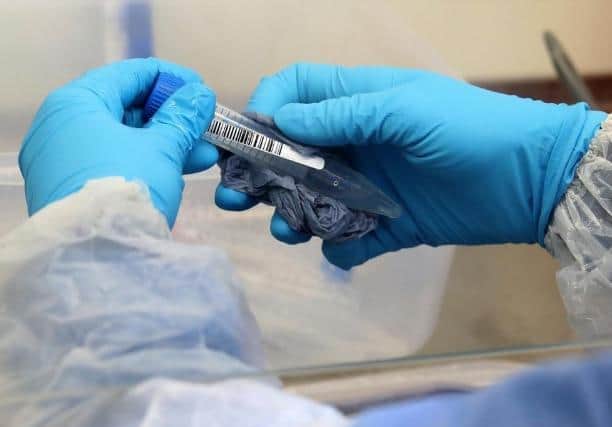 A new rapid Covid testing centre has opened in Brackley.