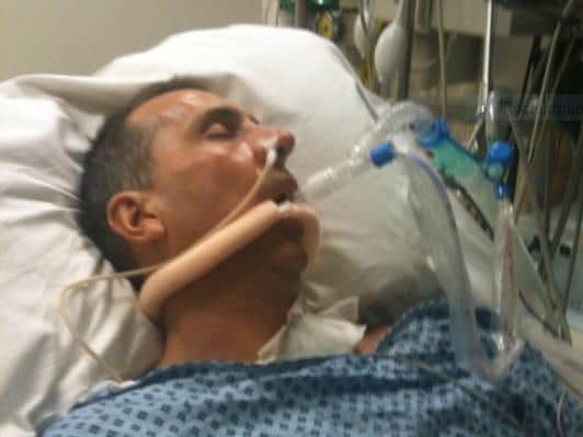Simon was put into an induced coma after life-saving surgery