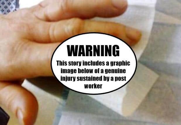 This image, uncensored further down this article, is of a genuine post worker's injury which the CWU shares to show the dangers posed by dogs to its members