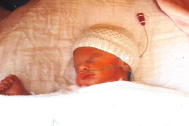 Emilia was born 12 weeks early and spent the first six weeks of her life in hospital