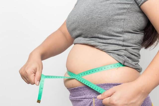 Childhood obesity can cause long-term health issues (Photo: Shutterstock)
