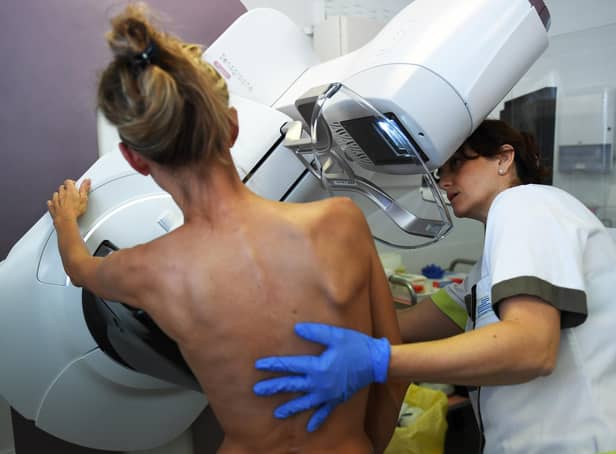 Breast screenings are available every three years in Northamptonshire to all women over 50