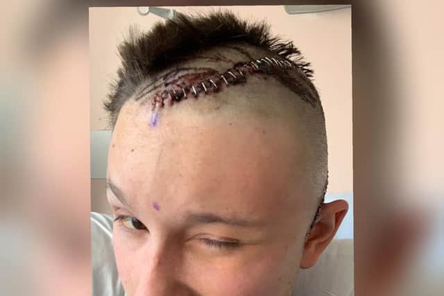 The shocking injuries PC Clarke suffered