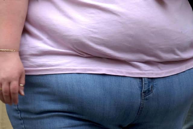 NHS chiefs say they are battling an obesity crisis in Northamptonshire's hospitals.