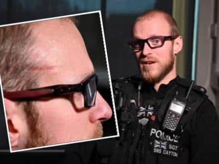 Sgt Cayton relives the moment a shooter fired at his face — the scar shows how close he came to serious injury