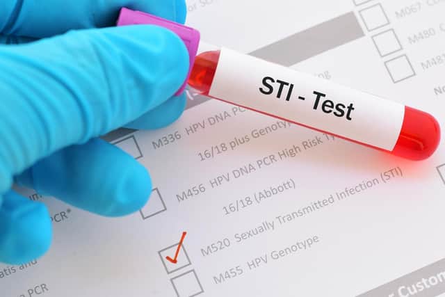 STI test. Photo: Shutterstock