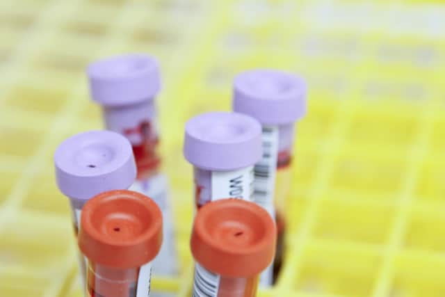 Blood tests