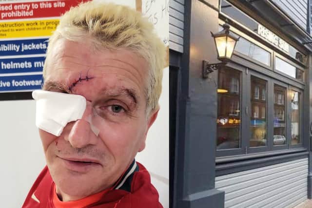 Dave Cooper was assaulted at The Rising Sun