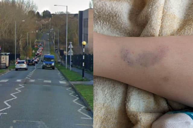 The crossing where the incident took place and bruising to Osvaldas' leg