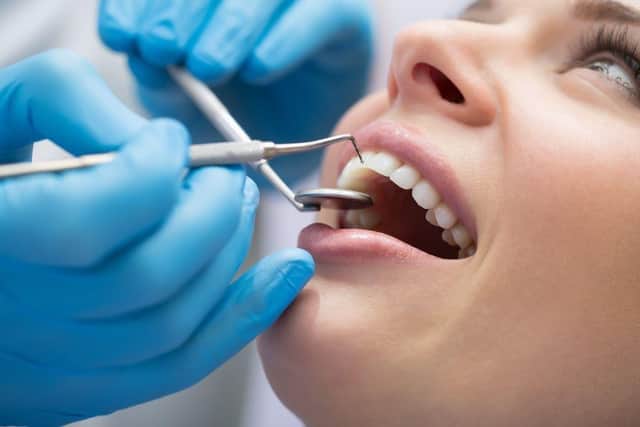 Dental Deserts - Millions unable to access Dental Care in the UK