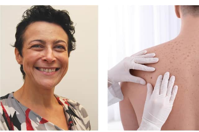 Dr Olivia Stevenson Kettering General Hospital’s Clinical Lead for Skin Cancer/skin check (KGH/National World)