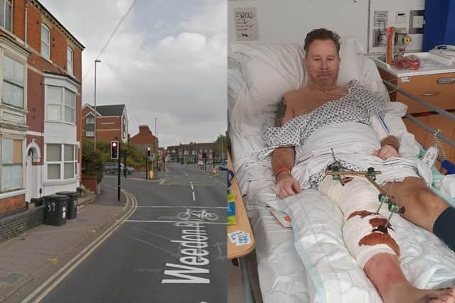 Stuart Johnson was hospitalised following an e-scooter collision with a delivery driver on Friday, January 13.