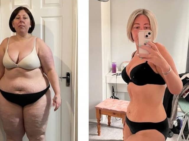 Aimee Coles before and after her eight stone weight loss.