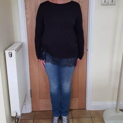 Sue before going on the diet