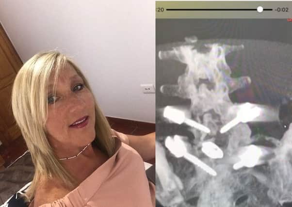 Tracey Watson and a X-ray image of her spine