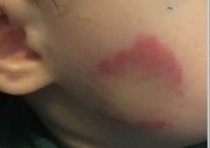 Police have issued this picture of the bite