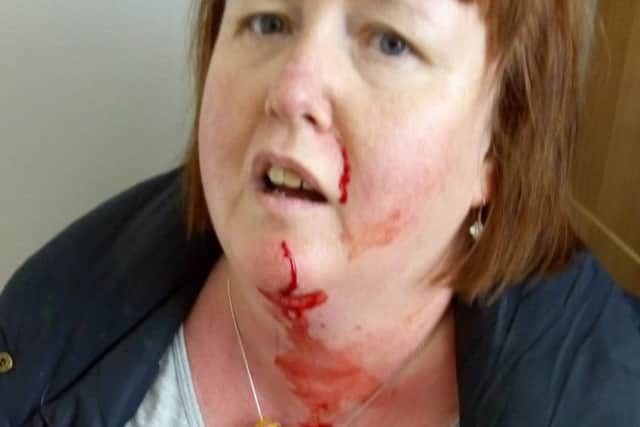 Trudi was injured by a Jack Russell in West Glebe Park