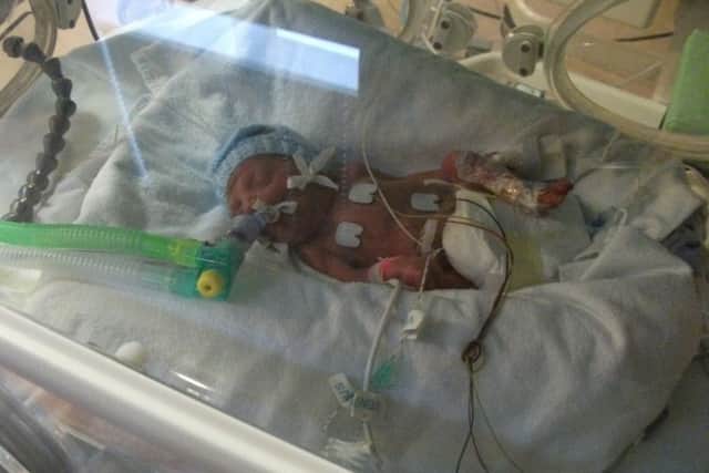 Sebastian as a premature baby born at 25 weeks