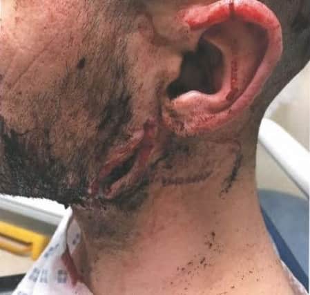 The side of Ashley Brittin's head following the incident NNL-190725-142732005