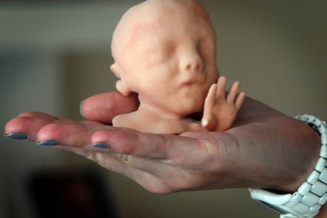 Expectant mums and dads can now hold their babies BEFORE they are born - with the introduction of 3D printed baby models. Photo: SWNS