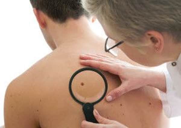 An annual skin cancer surveillance day is being held at Kettering General Hospital on Saturday, September 10