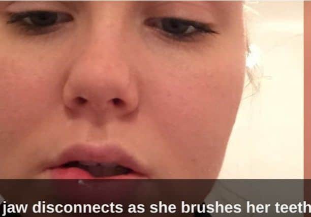 Her jaw disconnects when she is brushing her teeth