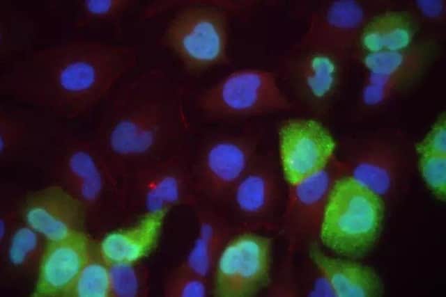 The superbug is immune to our strongest antibiotics.